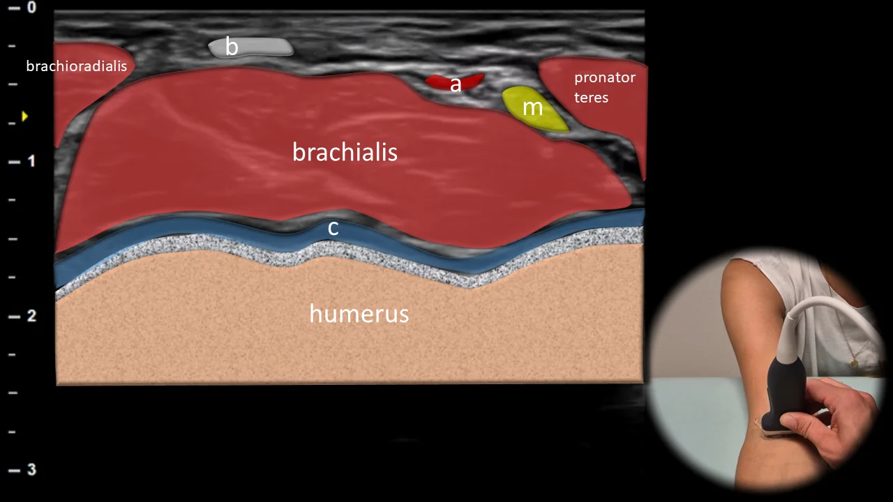 Figure 1 overlay