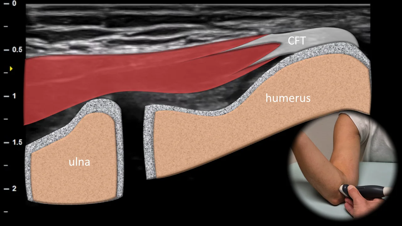Figure 5 overlay