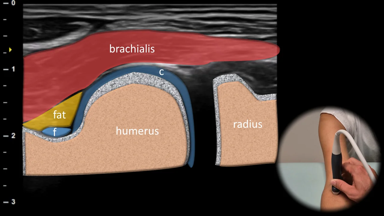 Figure 2 overlay