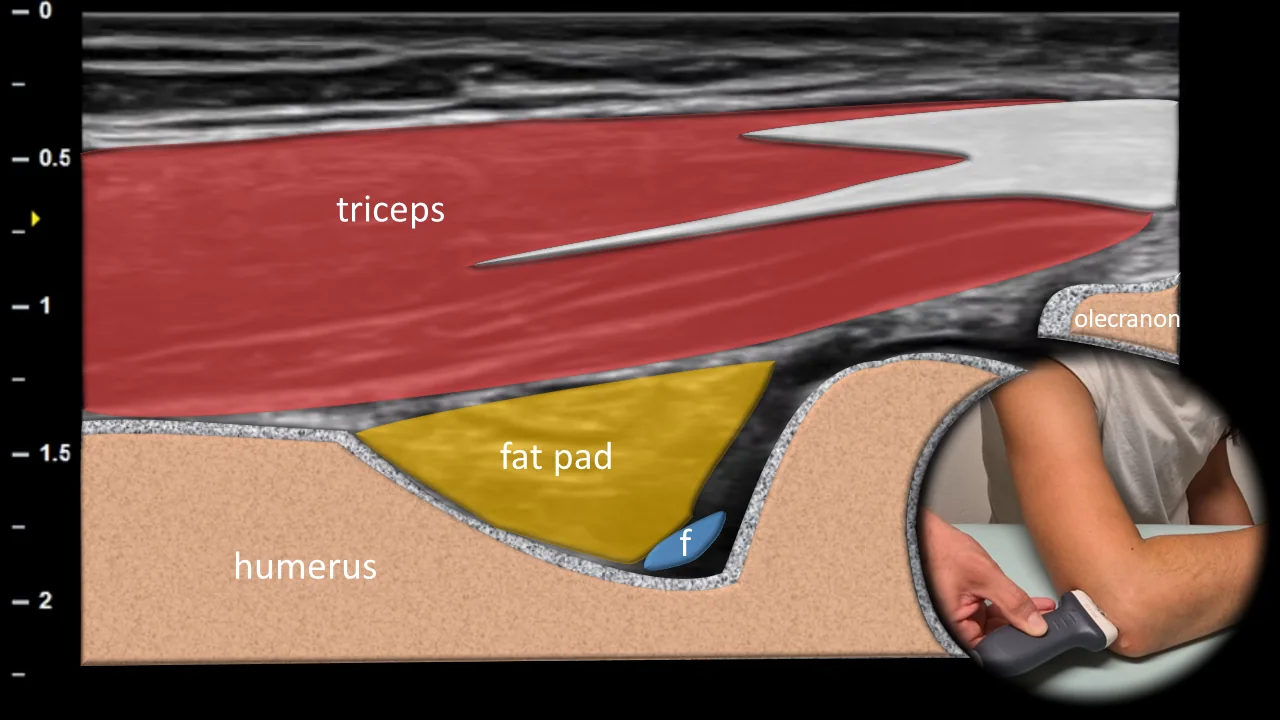 Figure 6 overlay