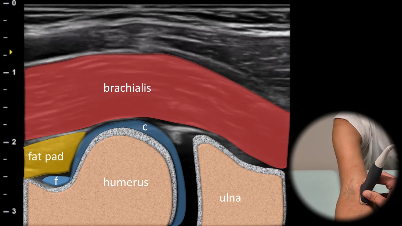Figure 3 overlay