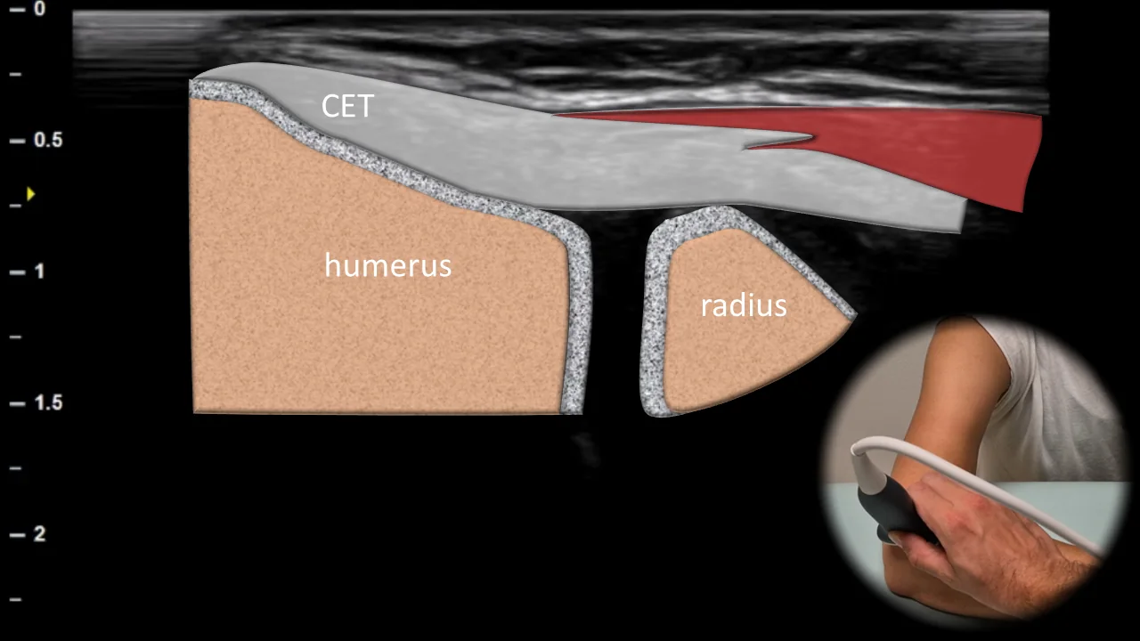 Figure 4 overlay