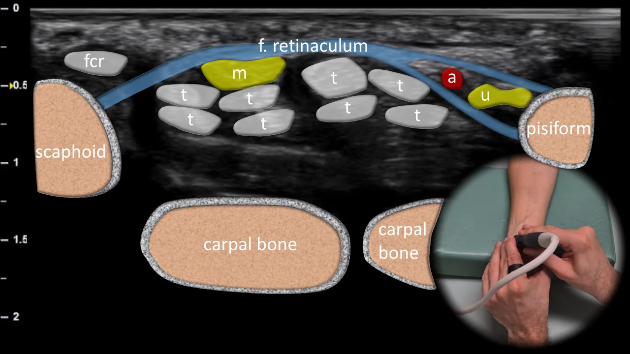Figure 1 overlay