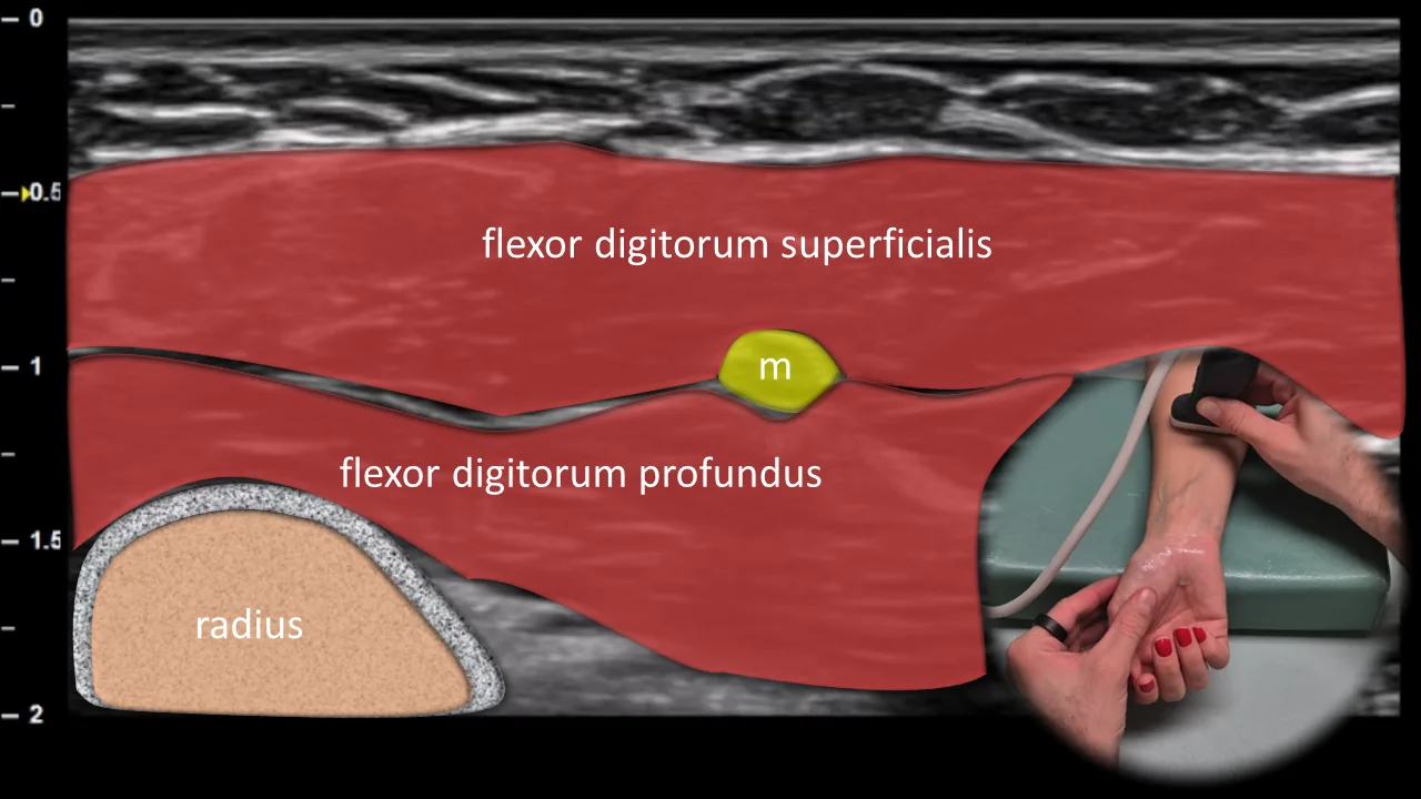 Figure 2 overlay