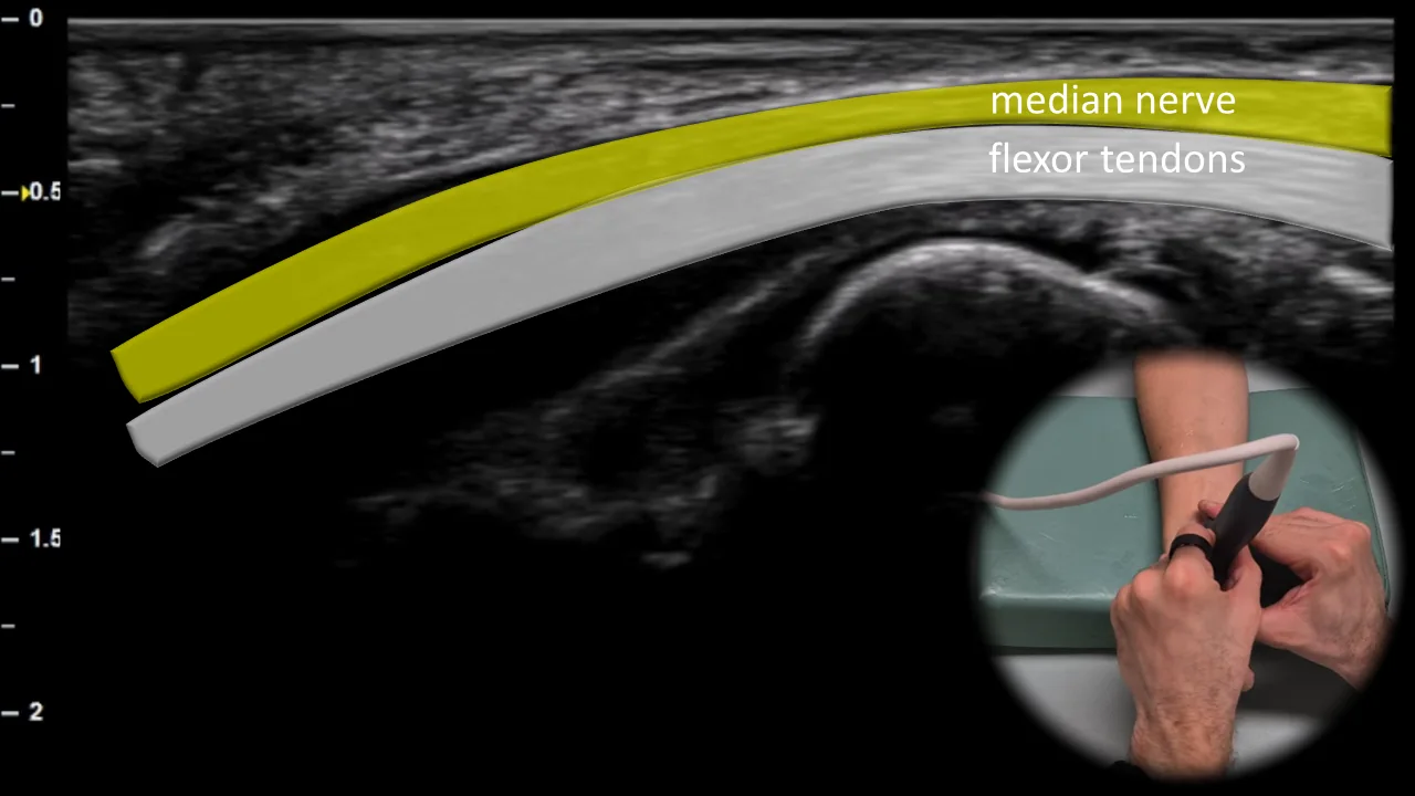 Figure 3 overlay