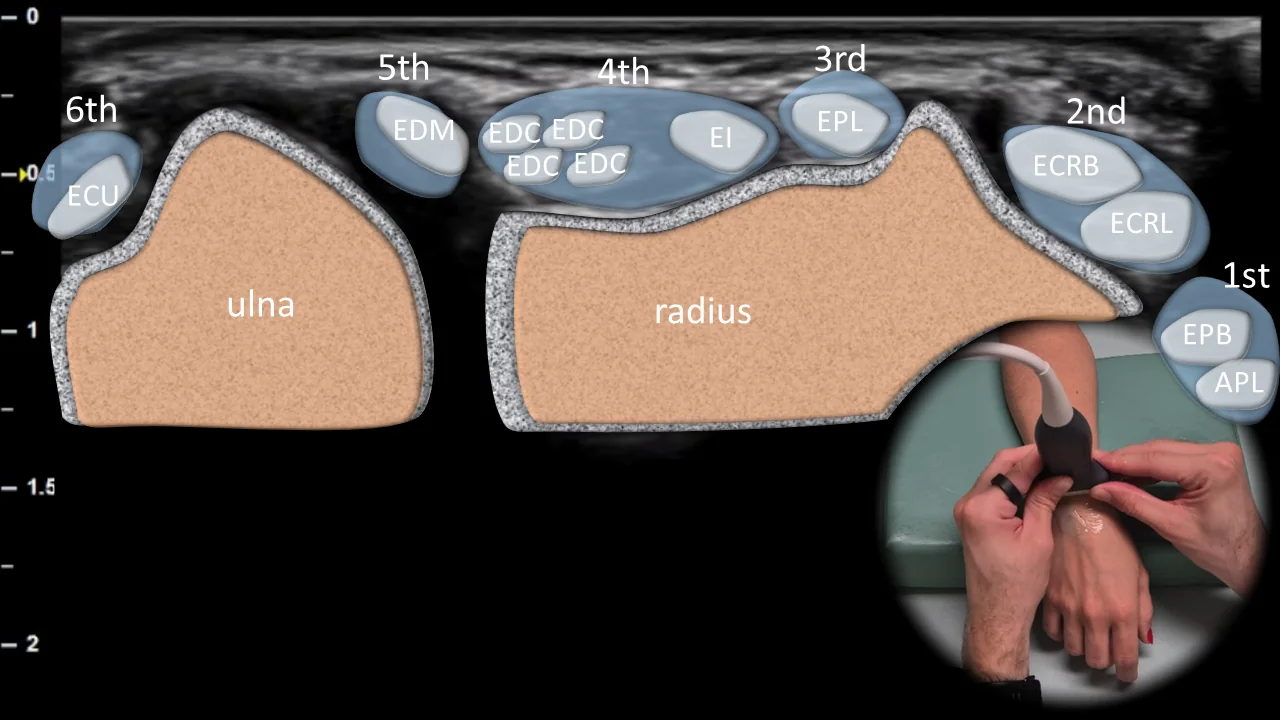 Figure 4 overlay