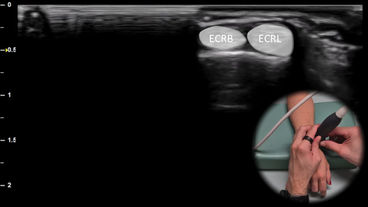 Figure 5 overlay