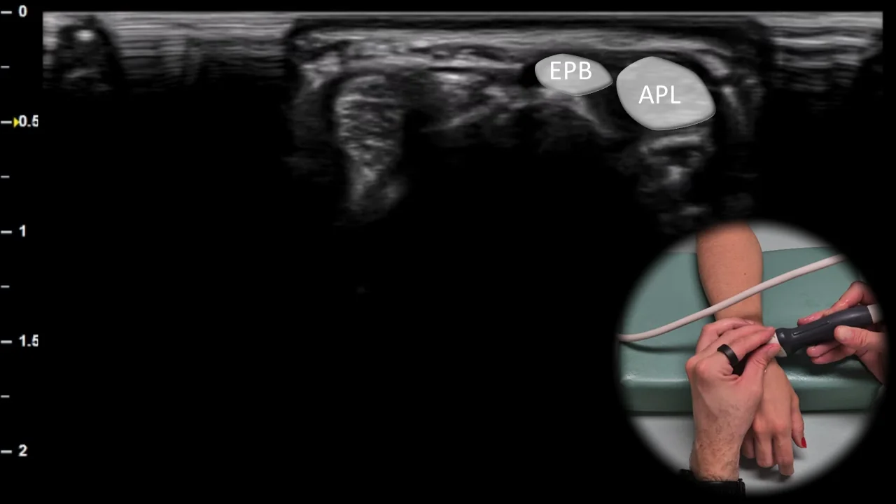 Figure 6 overlay