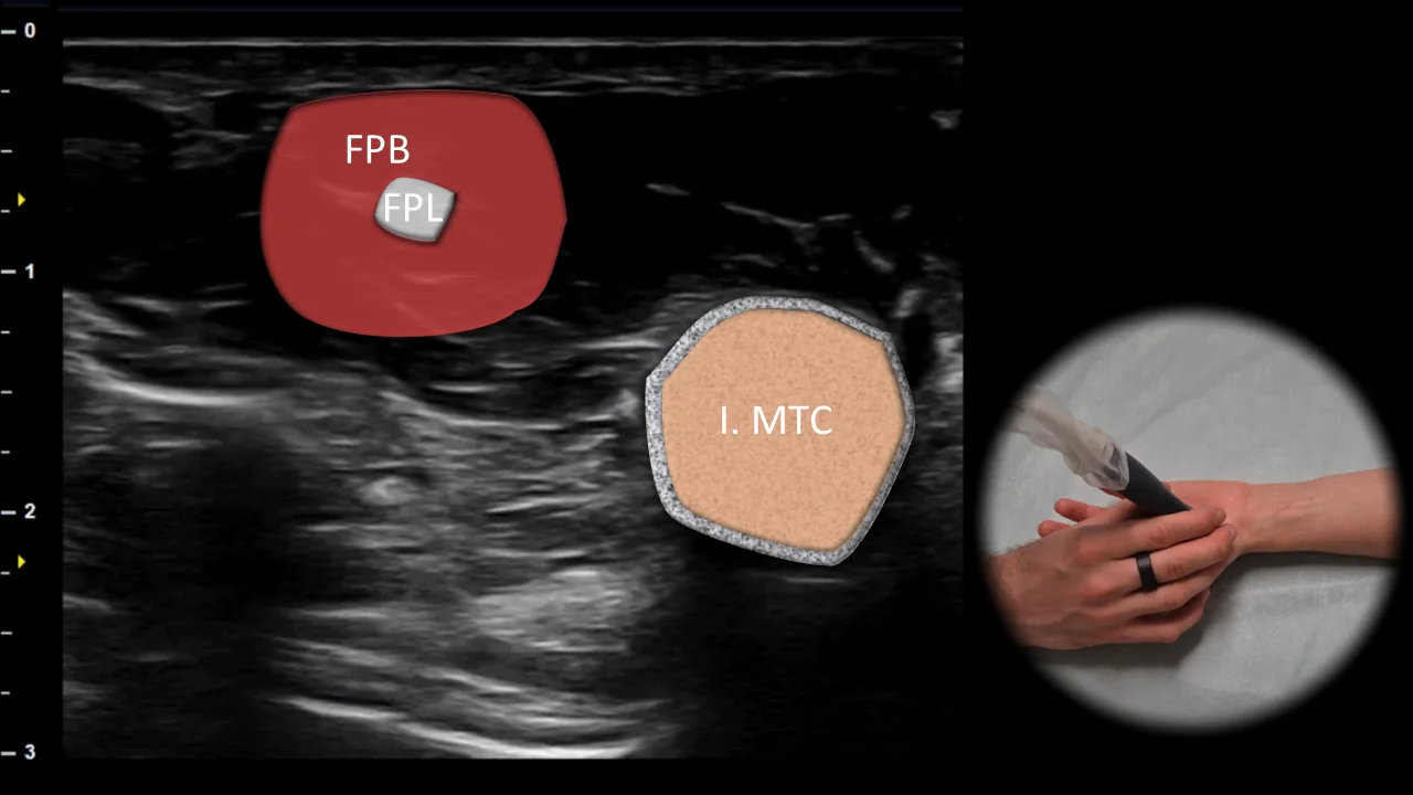 Figure 9 overlay