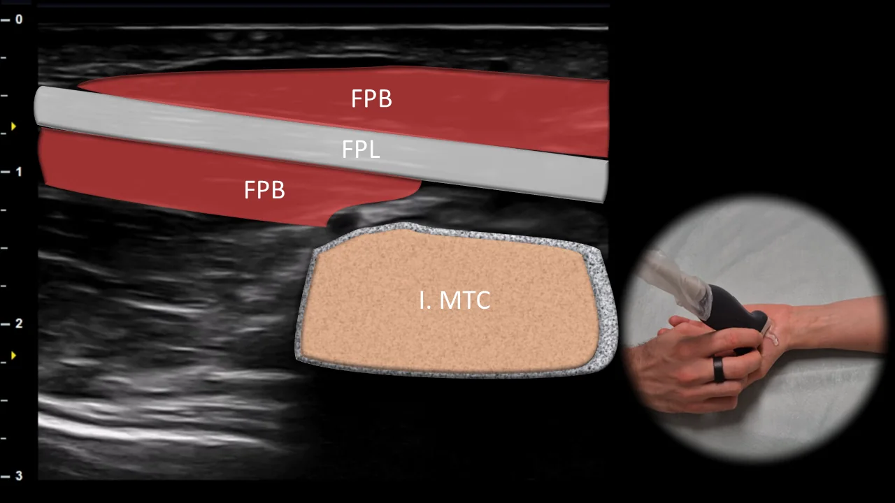 Figure 10 overlay