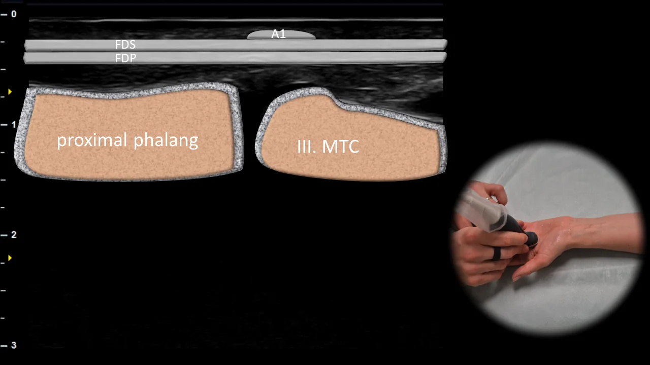 Figure 11 overlay