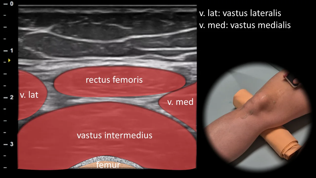 Figure 1 overlay