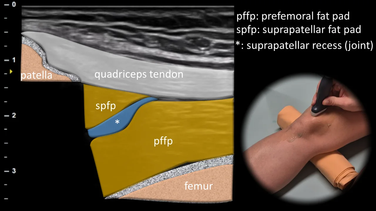 Figure 2 overlay