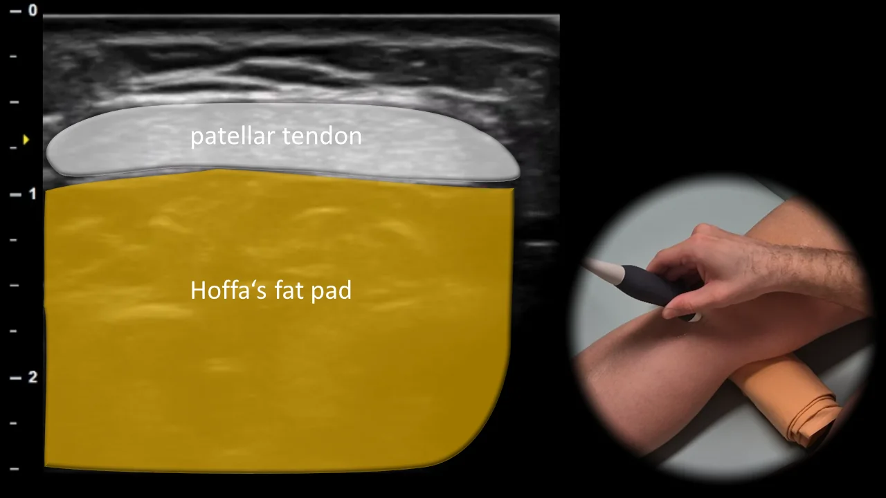Figure 3 overlay