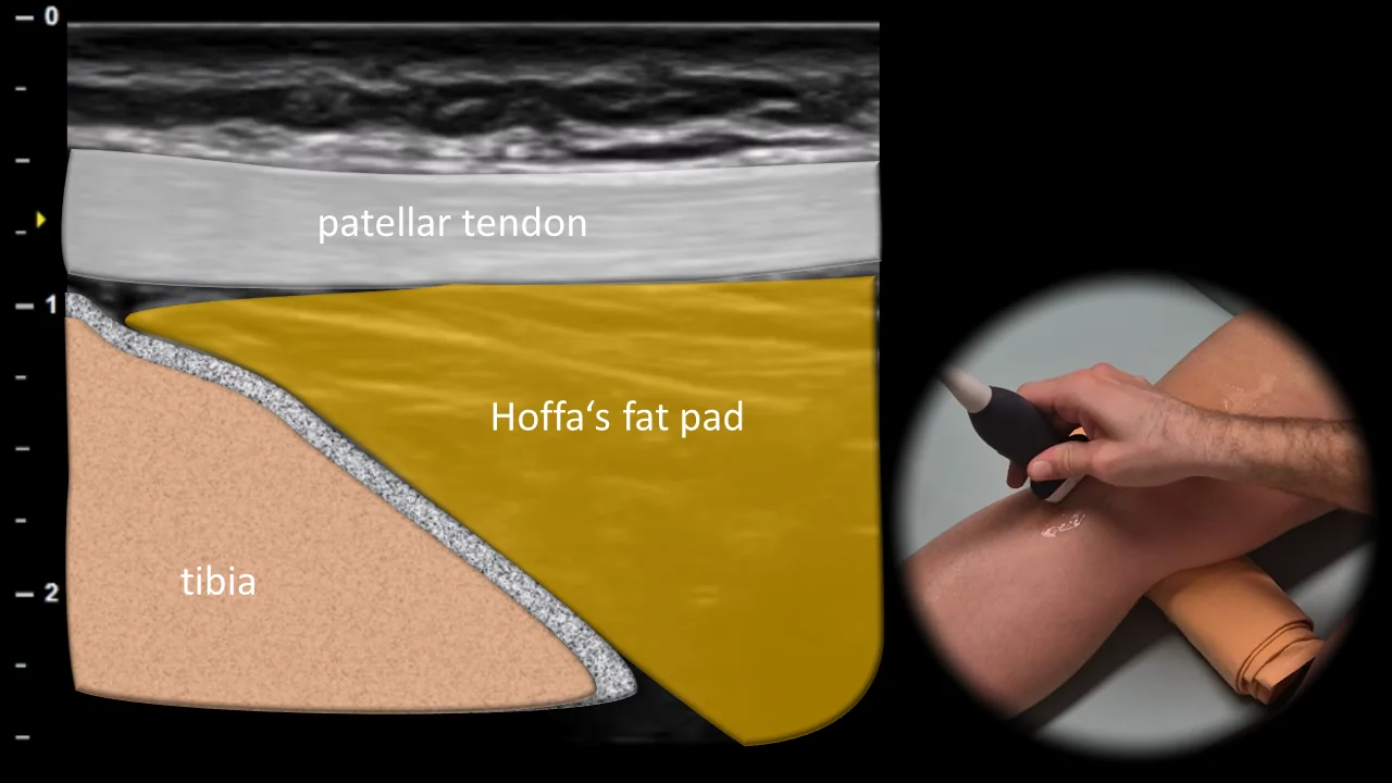 Figure 4 overlay