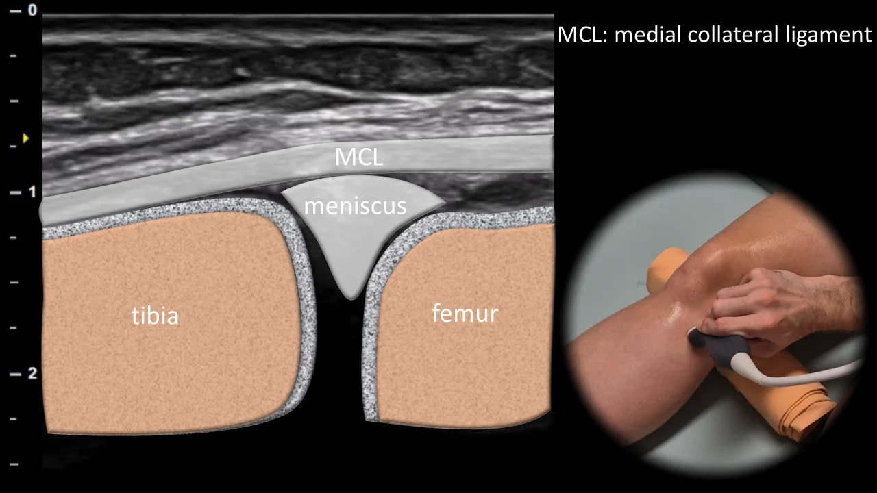 Figure 5 overlay