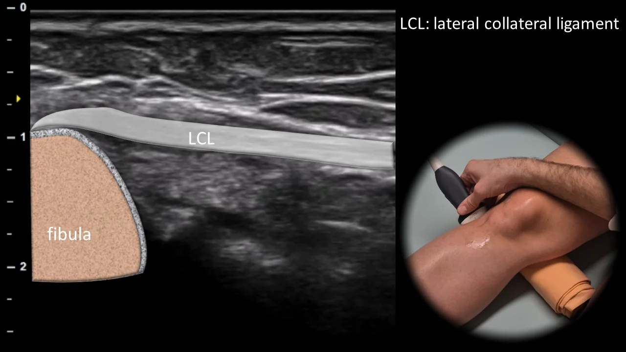 Figure 6 overlay