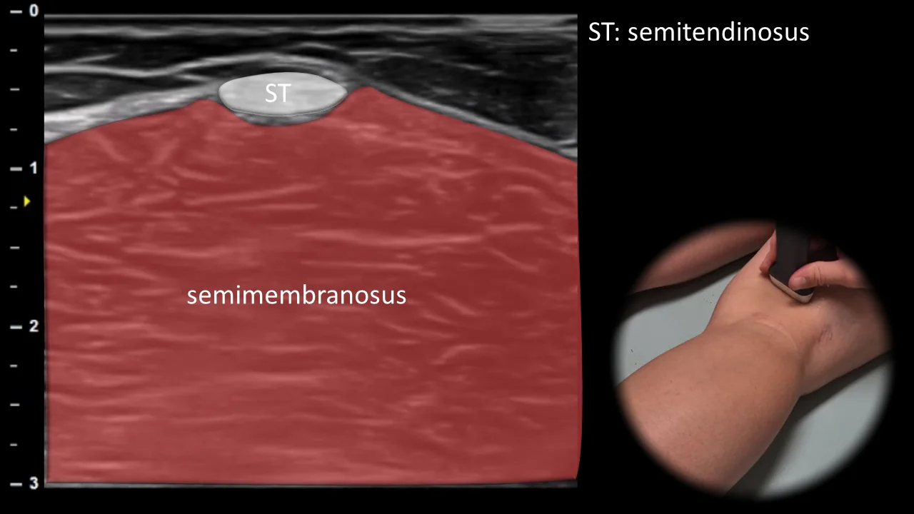 Figure 7 overlay