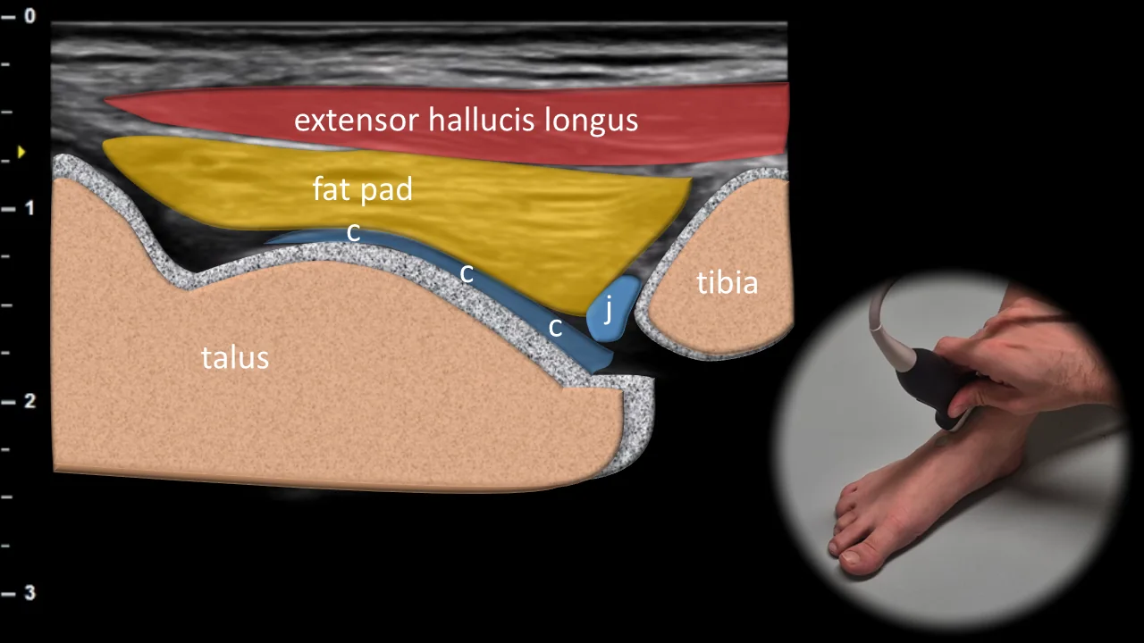 Figure 1 overlay