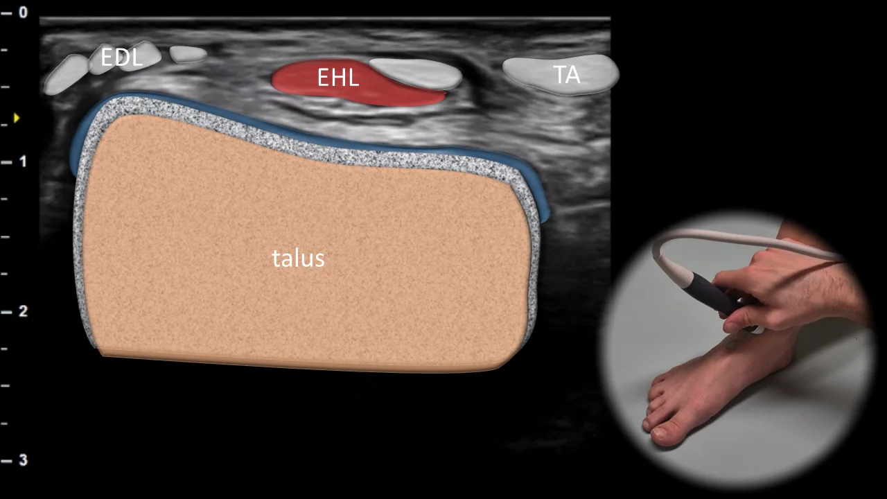 Figure 2 overlay