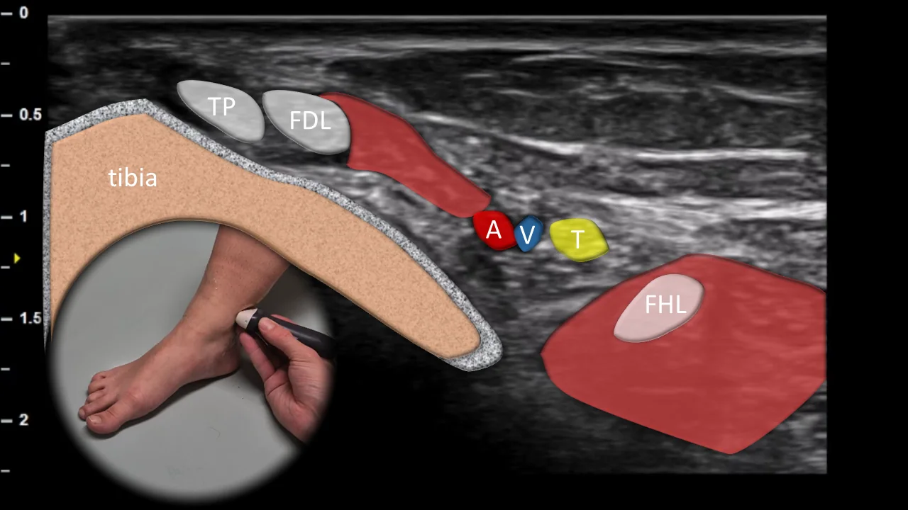 Figure 3 overlay