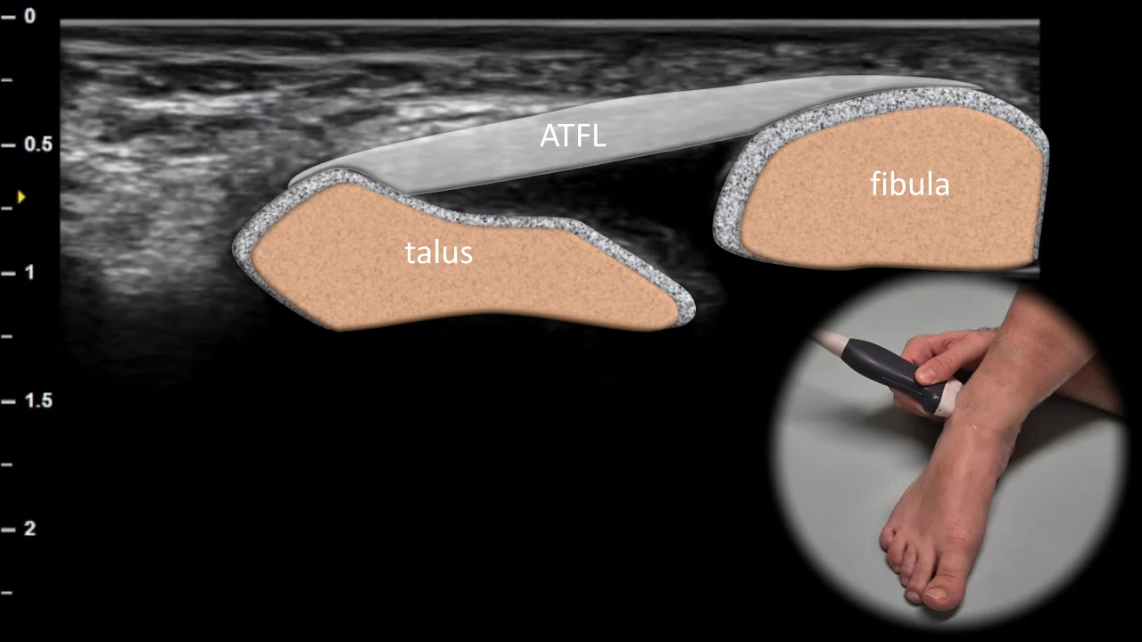 Figure 4 overlay