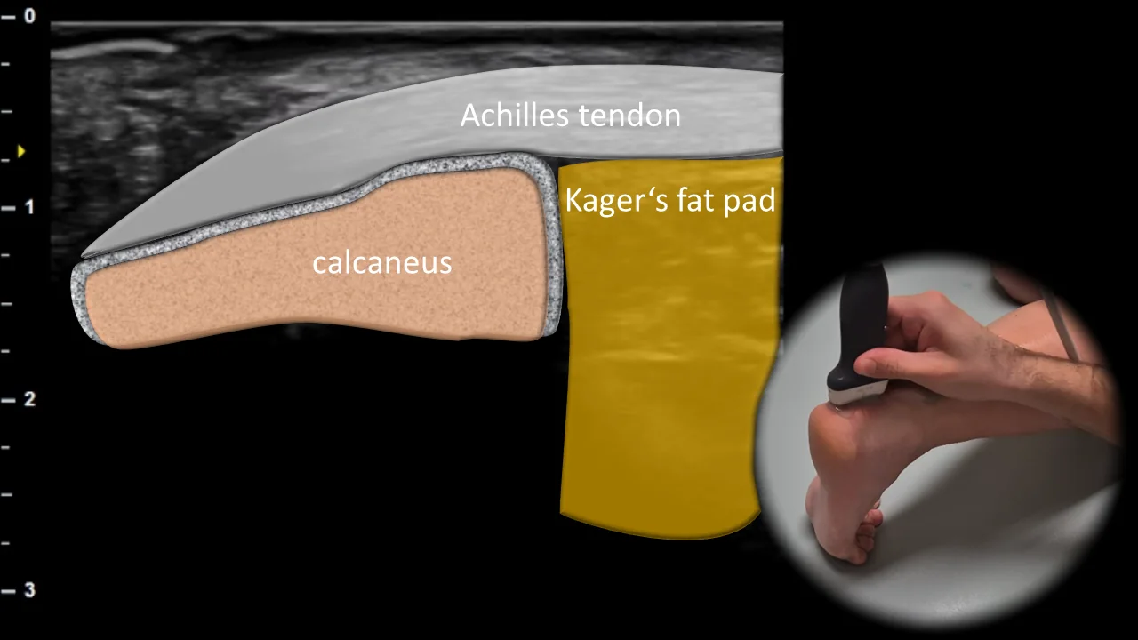 Figure 5 overlay