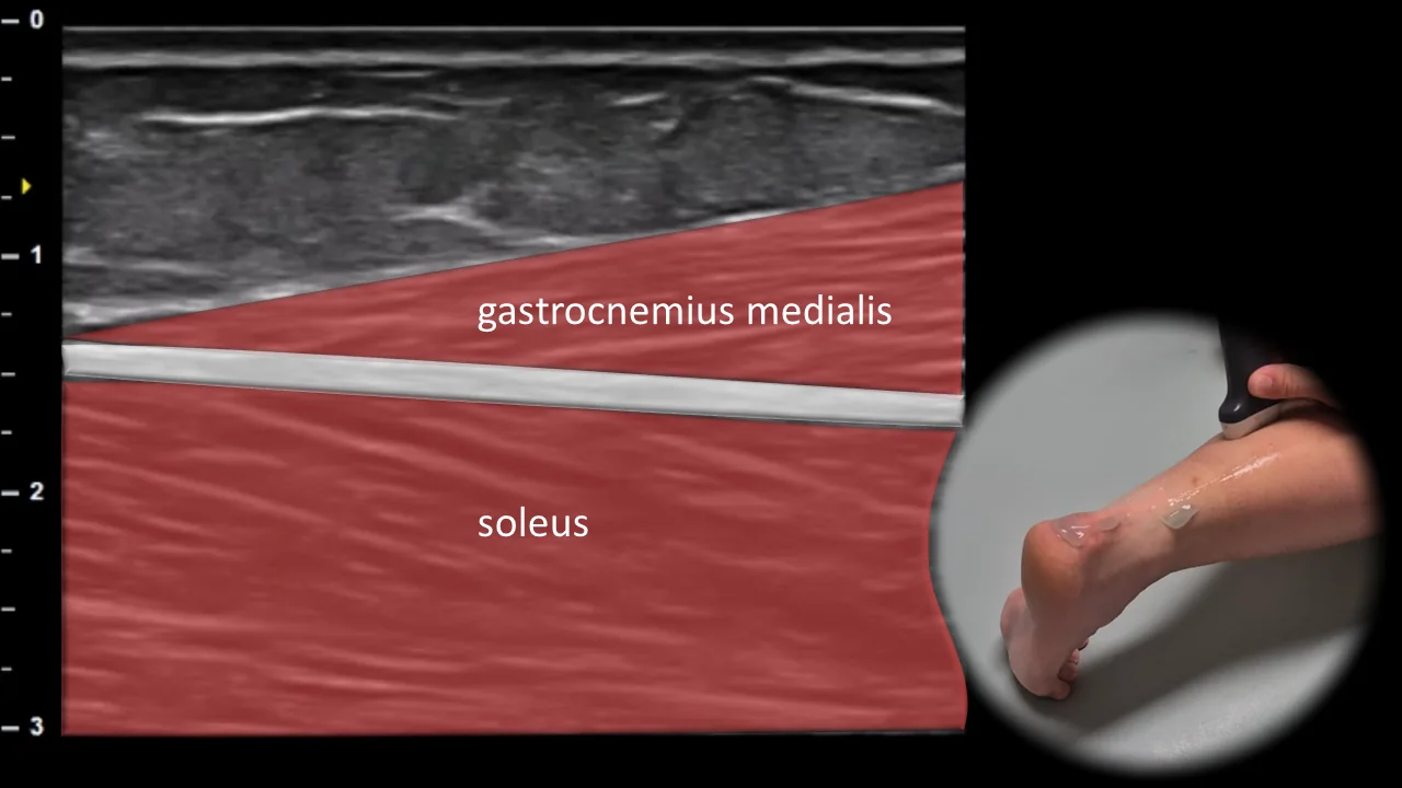 Figure 6 overlay