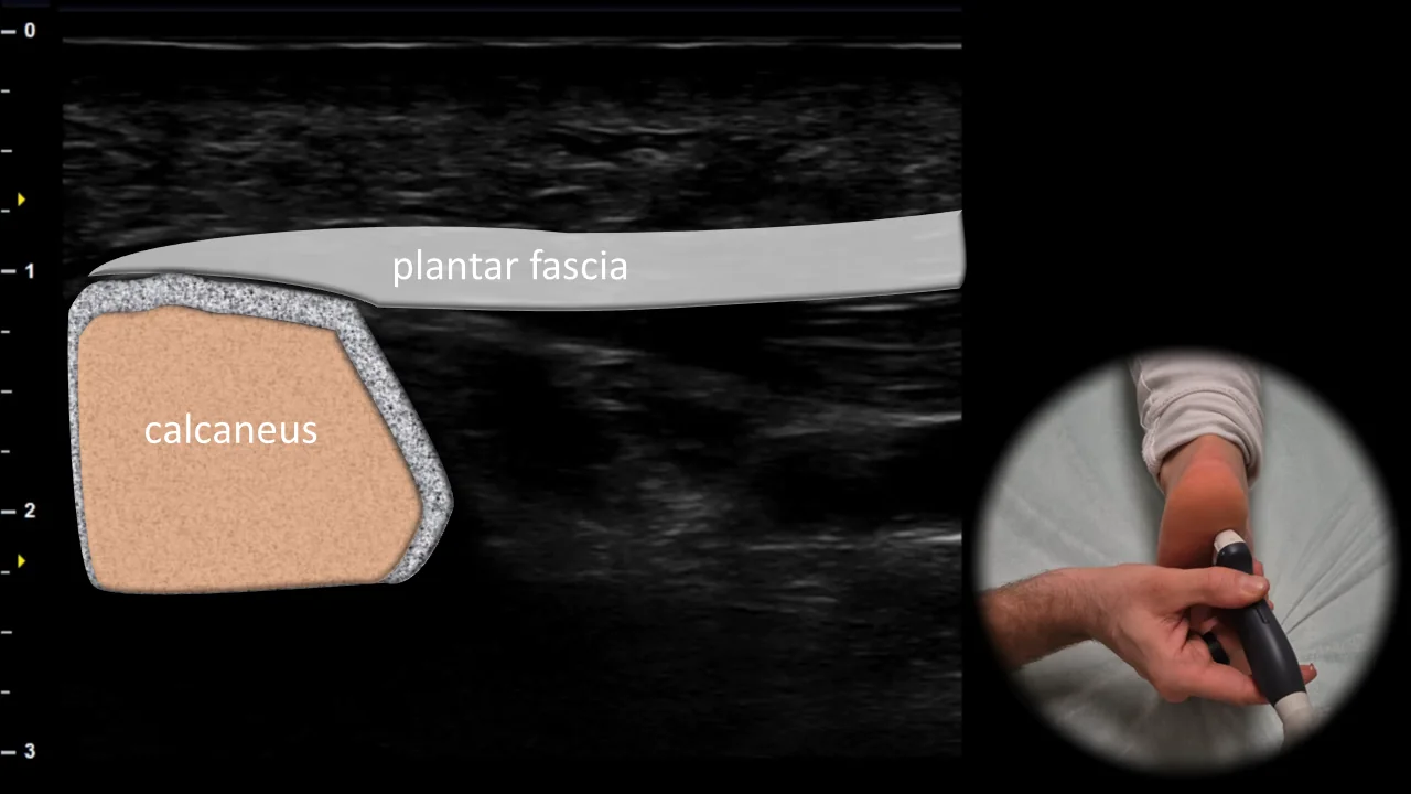 Figure 9 overlay