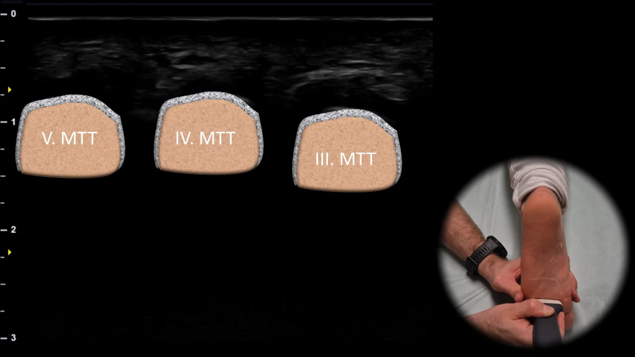 Figure 10 overlay