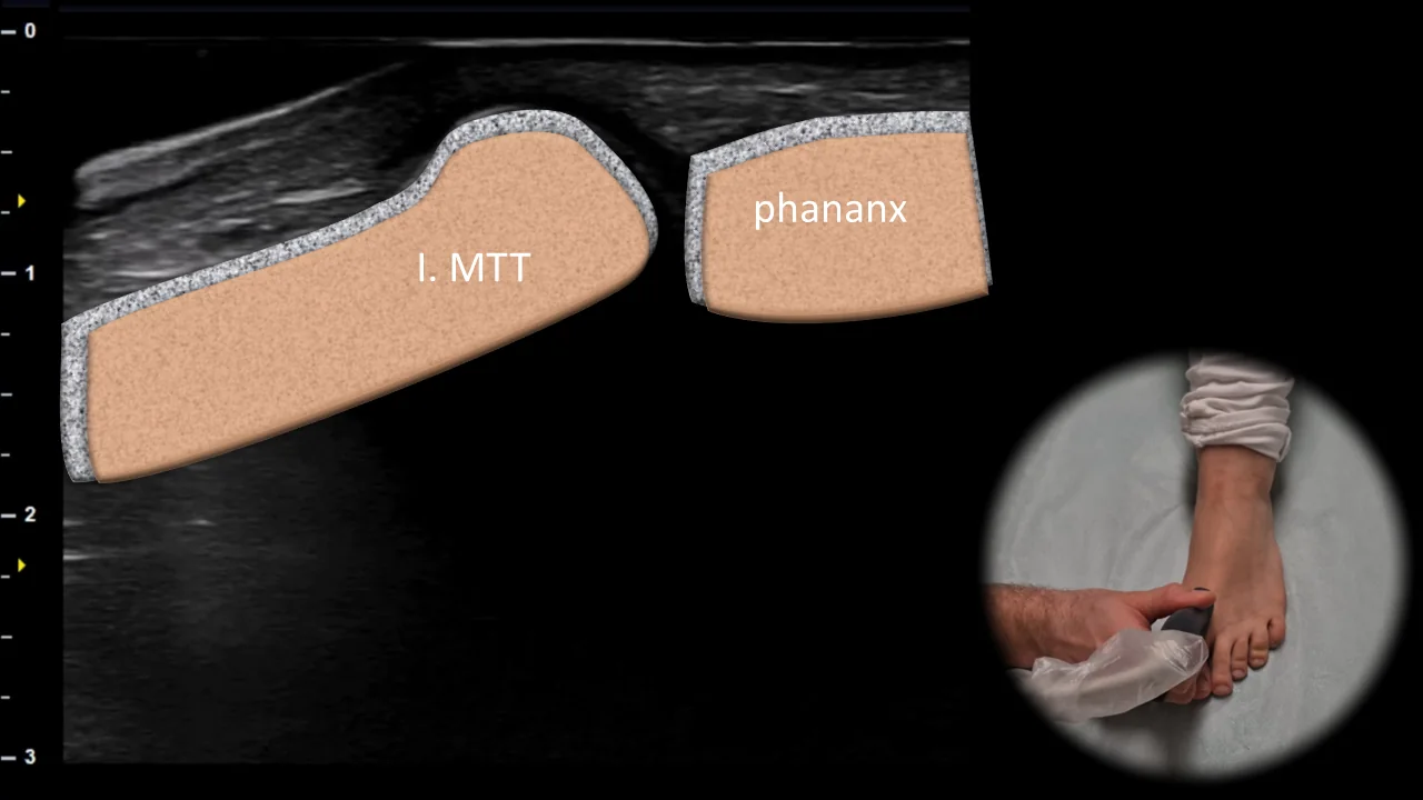 Figure 11 overlay