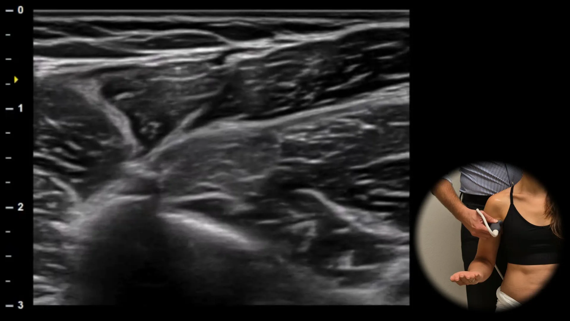 Anterior view - transverse plane 2