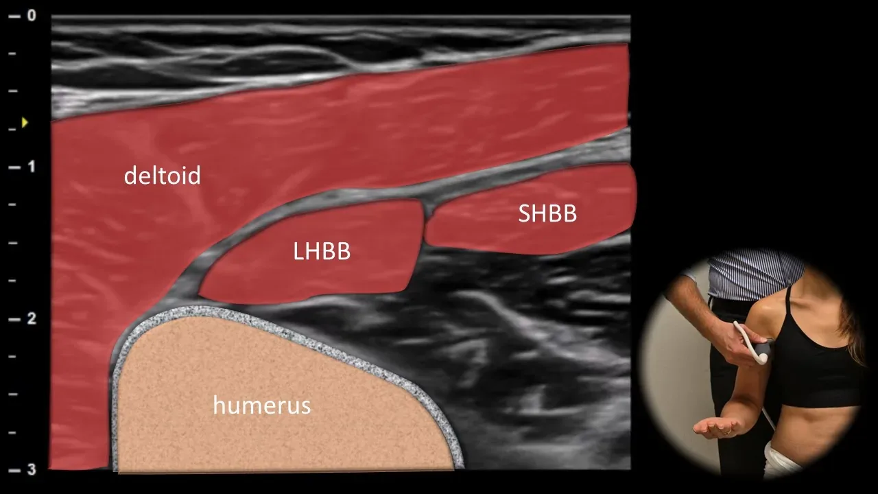 Anterior view - transverse plane 2