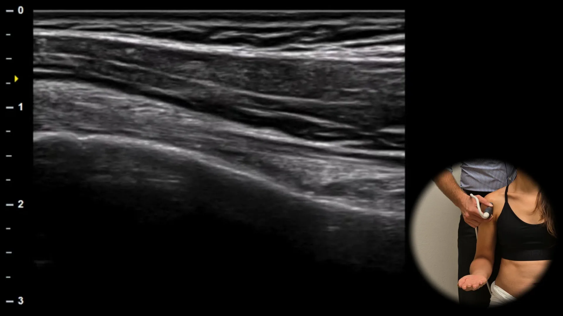 Anterior view - longitudinal plane