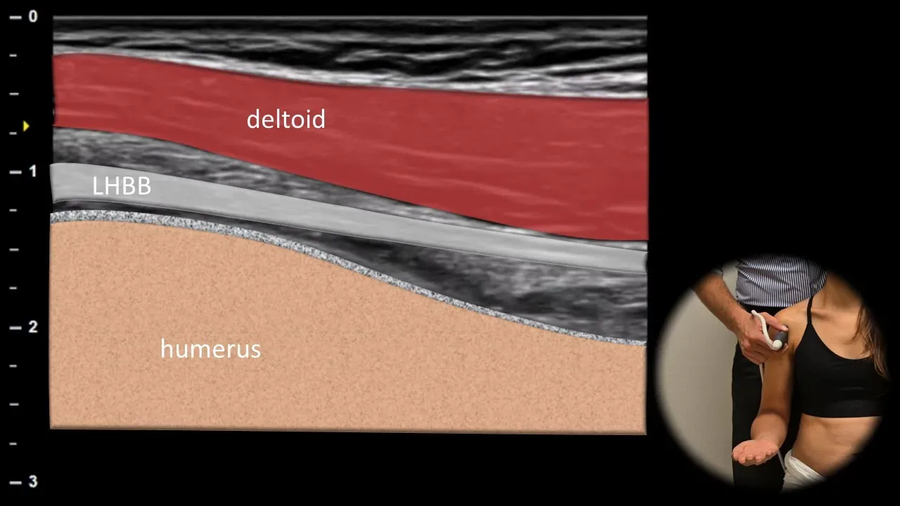 Anterior view - longitudinal plane