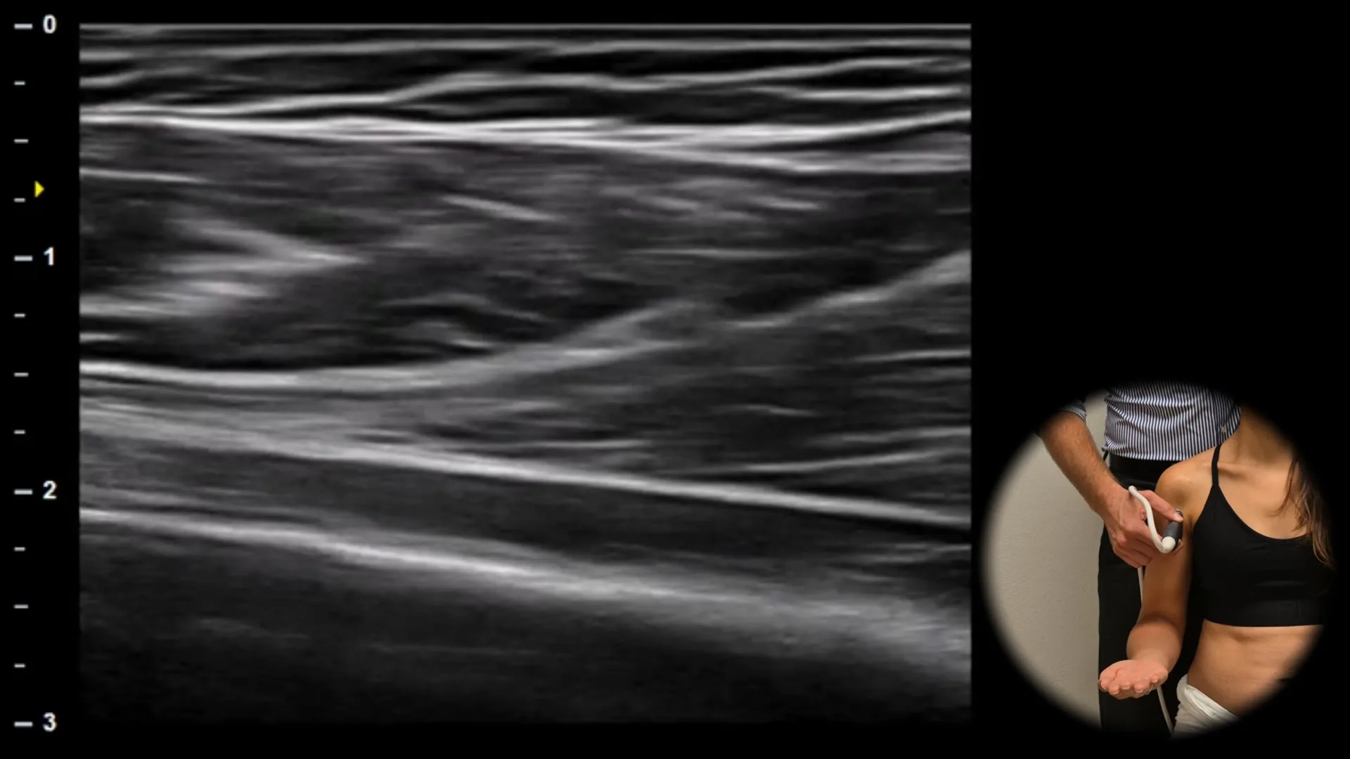 Anterior view - longitudinal plane 2
