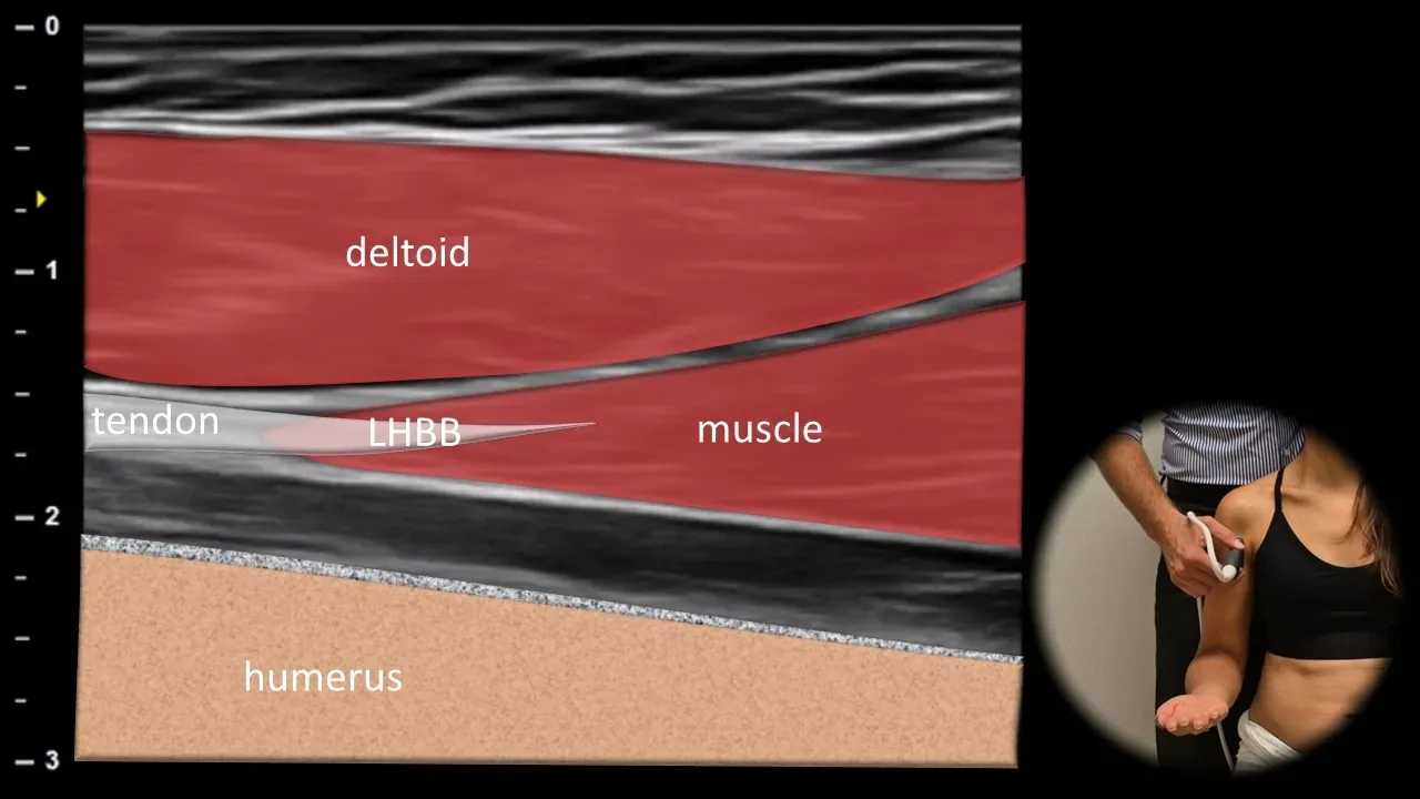Anterior view - longitudinal plane 2