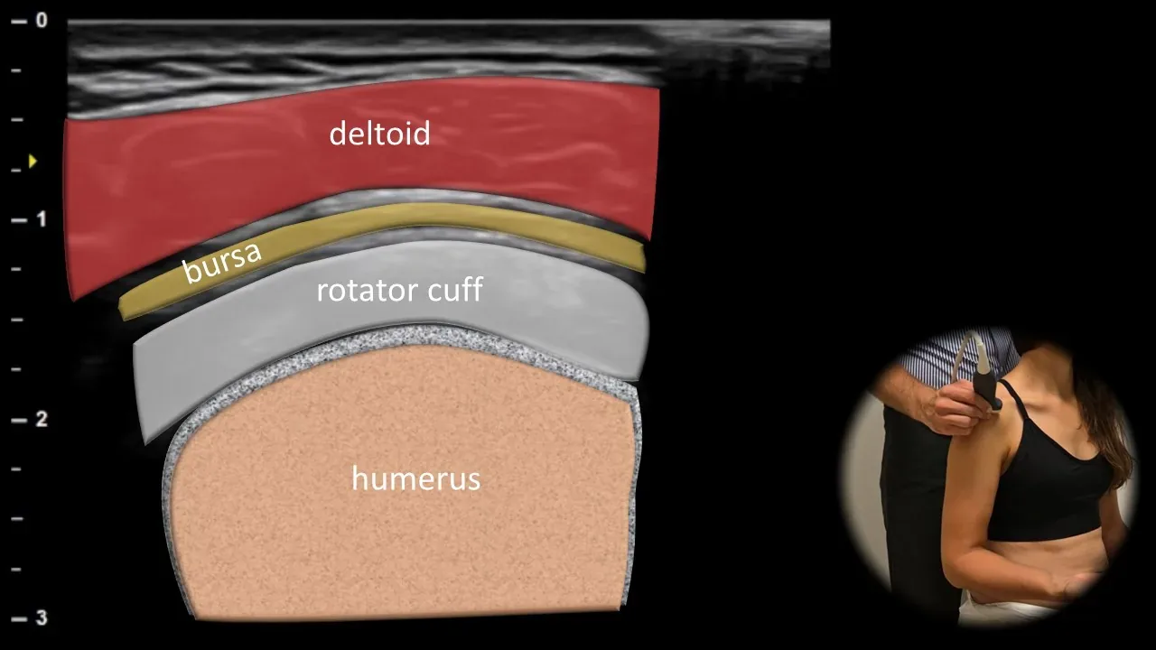 Lateral view - transverse plane