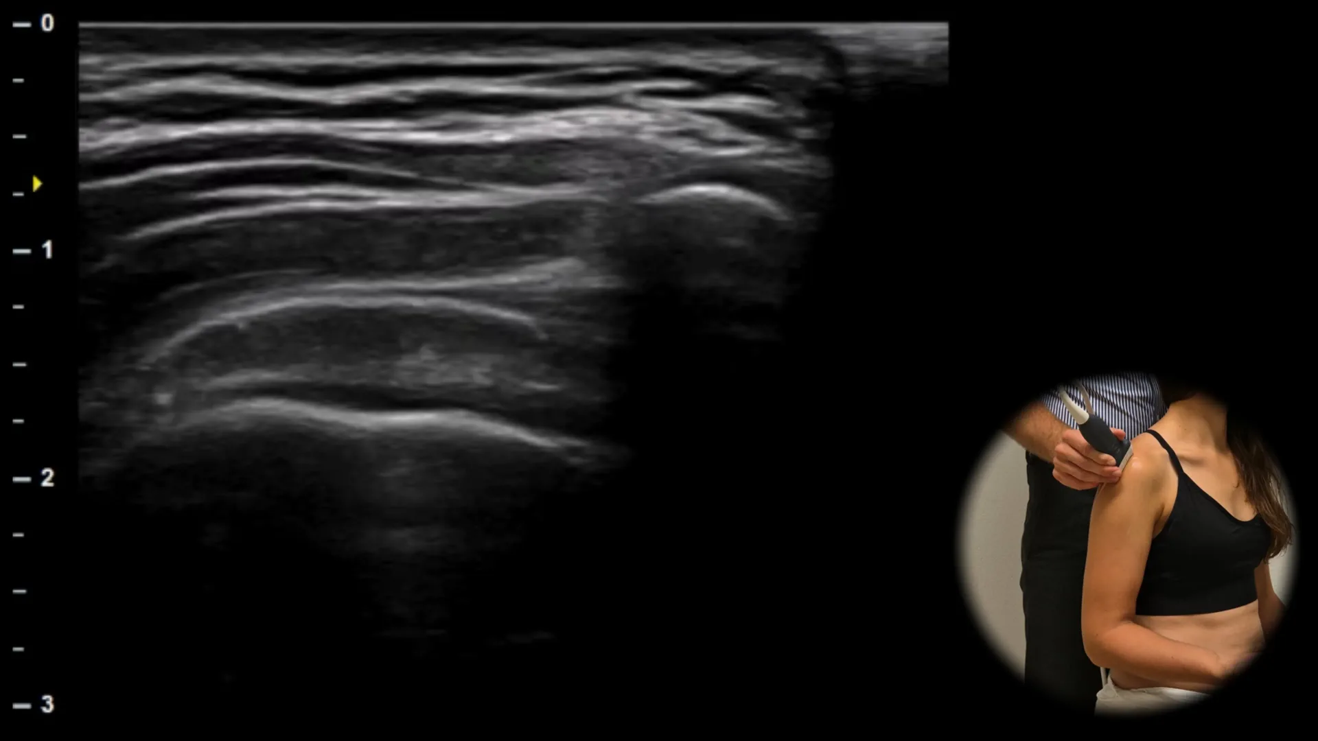 Lateral view - longitudinal plane