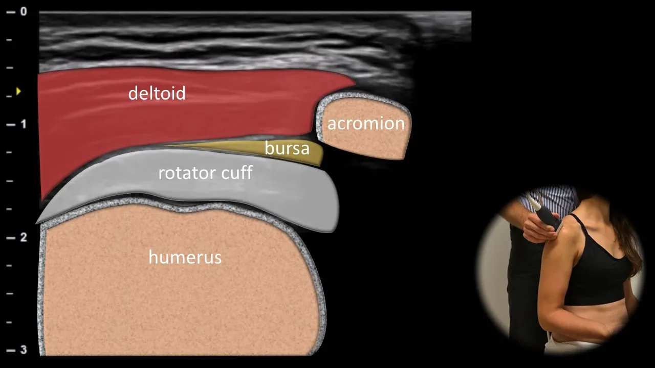Lateral view - longitudinal plane