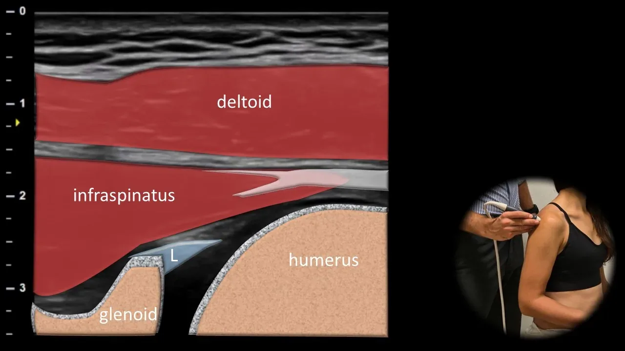 Posterior view - transverse plane