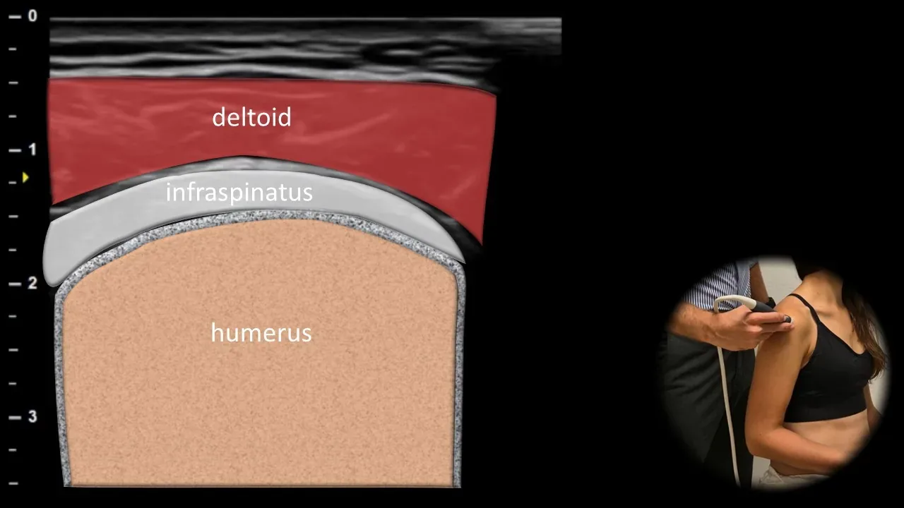 Posterior view - transverse plane 2
