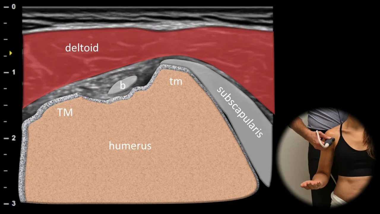 Anterior view - transverse plane