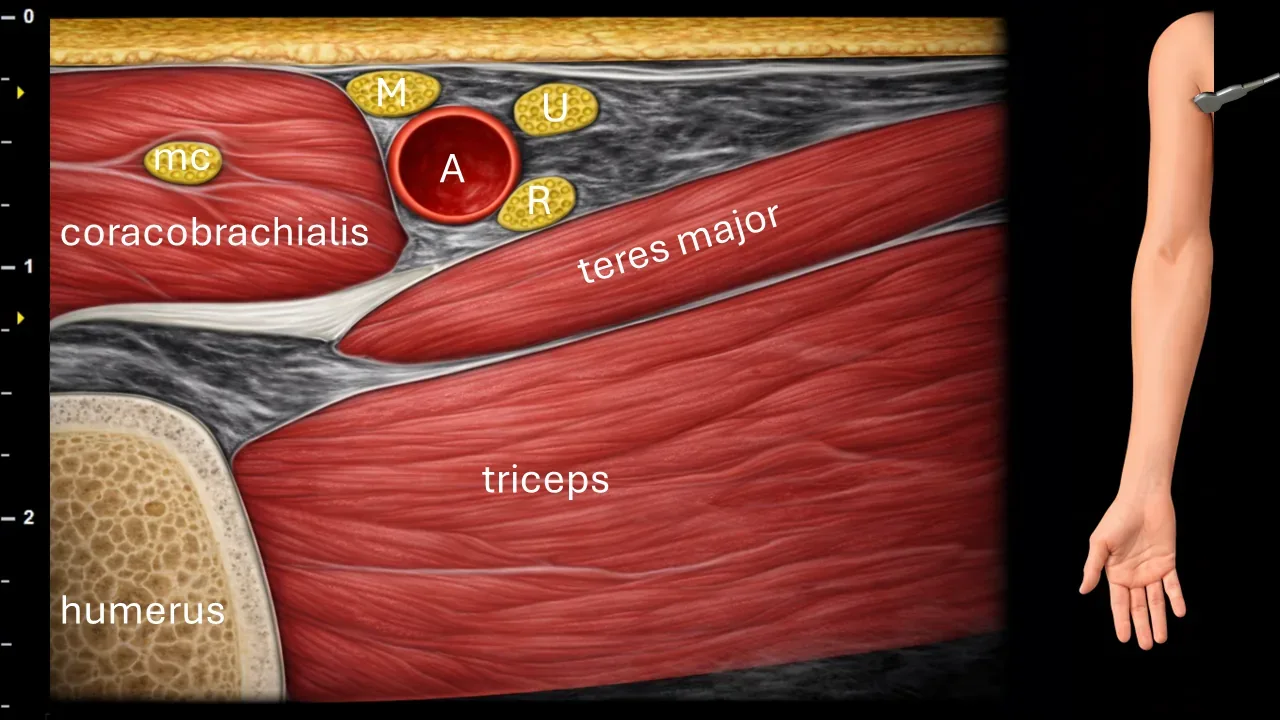 Figure 1 with labels