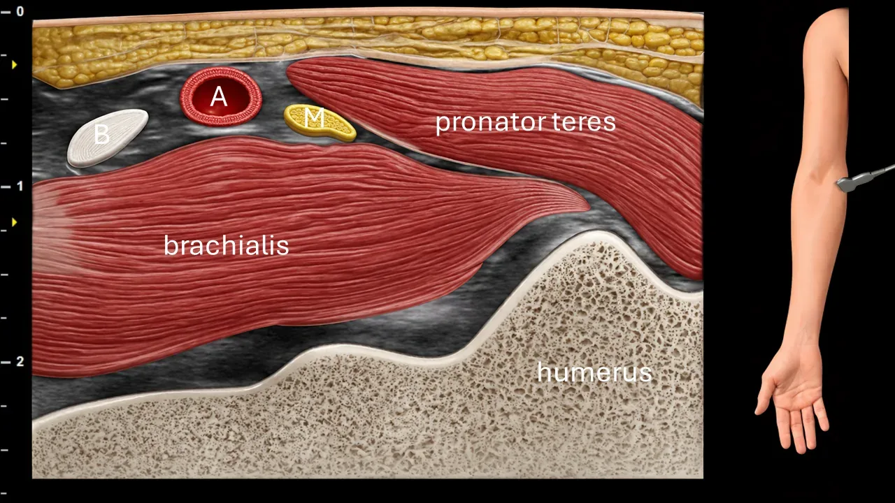 Figure 4 with labels