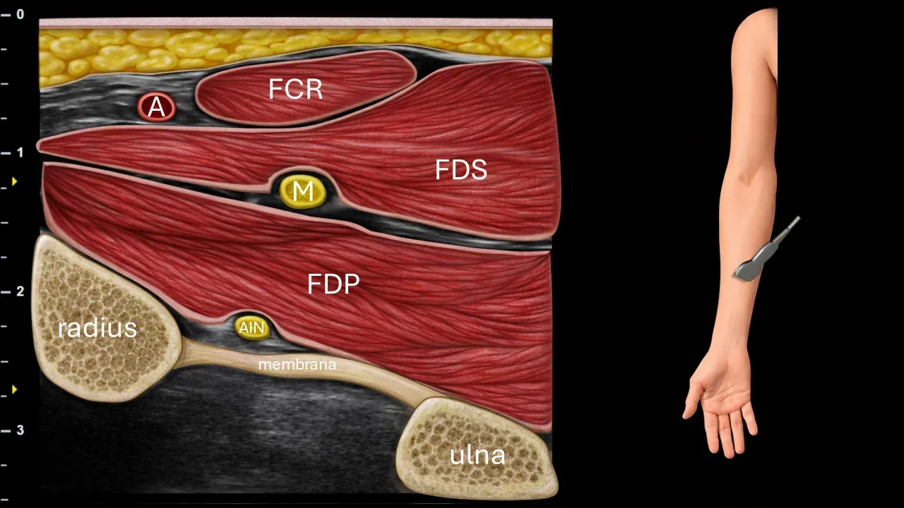 Figure 10 with labels