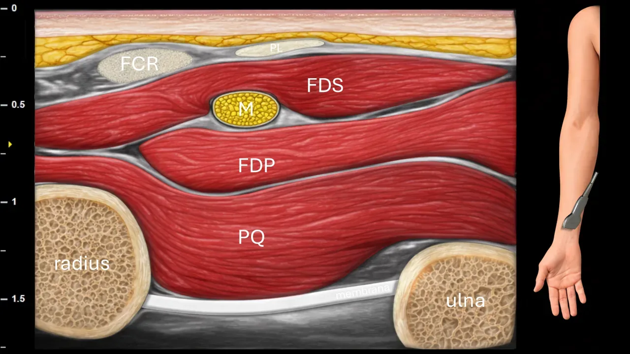 Figure 11 with labels