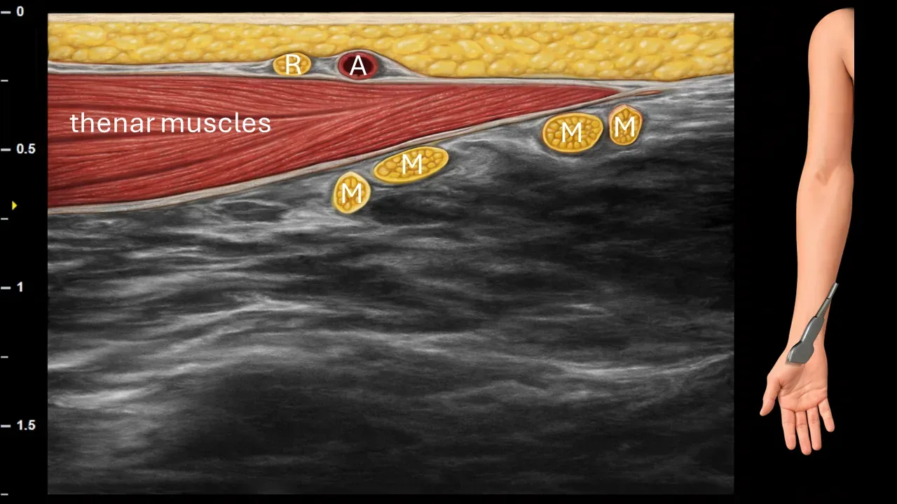 Figure 15 with labels
