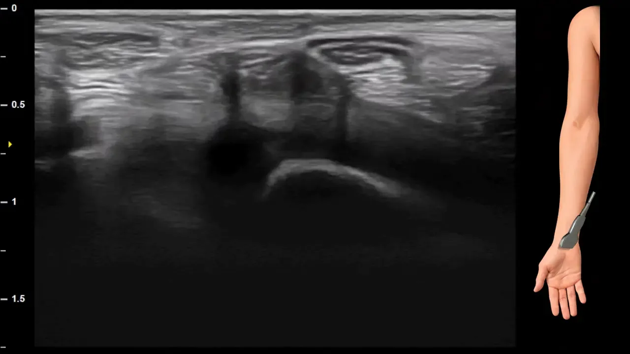 Figure 13 without labels