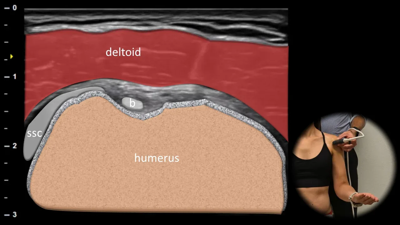 Figure 1 with labels